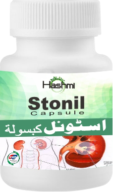 Treatments for Kidney Stones what is kidney stones, kidney stones, kidney stones treatment